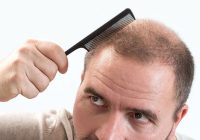 Przyczyny łysienia telogenowego