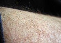 Czym zajmuje się dermatolog?